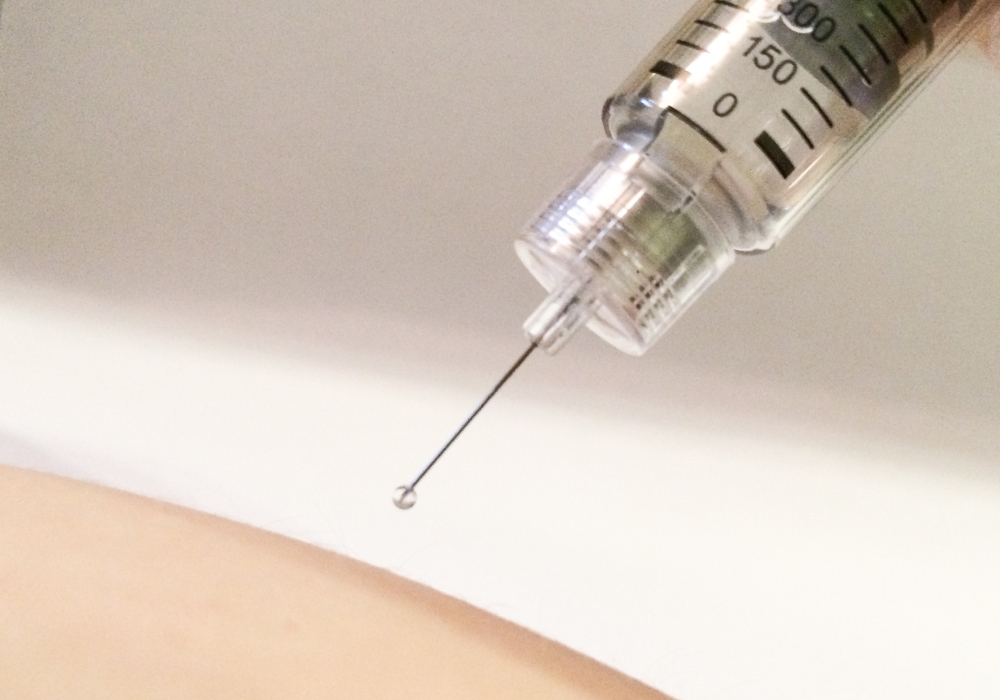 Infiltrações para Alívio da Dor: Como Funcionam e Quando São Indicadas